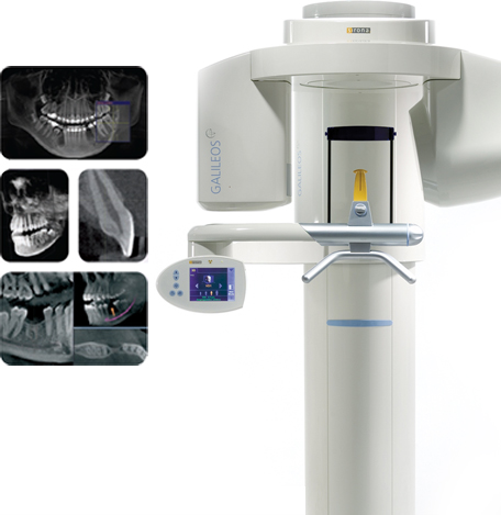Cerec