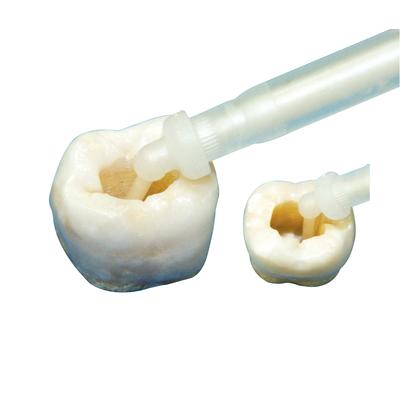 United concordia root canal cost