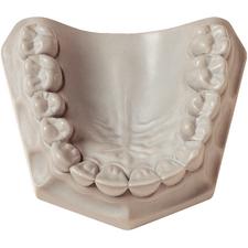 Orthodontic Plaster – Super White, 33 lb