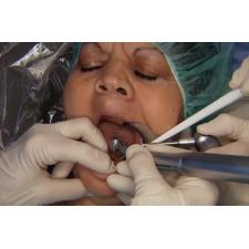Dr. Christensen's Placing Mini Implants DVD