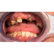 Dr. Christensen's Oral Surgery in General Practice DVD