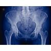 RADIOMAT™ Duplicating Medical X-Ray Film – 8" x 10", 100/Box